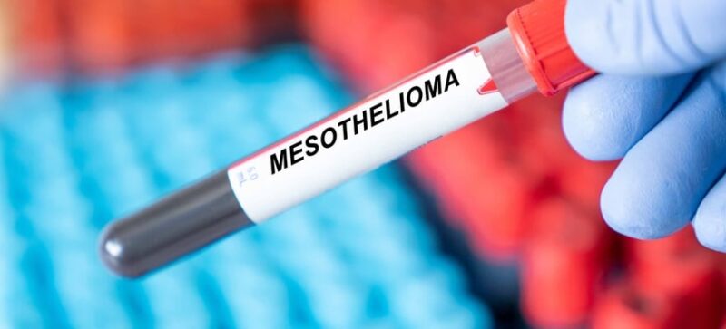 Diagnosis for Mesothelioma Process and Testing