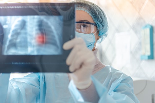 Imaging Scans in Identifying Mesothelioma | Types of Scans