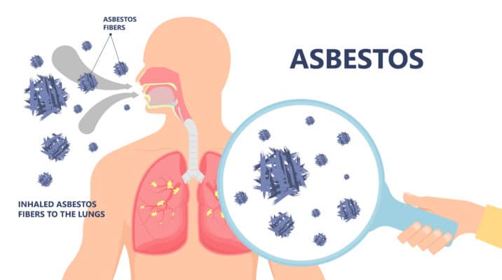 What is Asbestos Mesothelioma We Can Help Exposure Risk